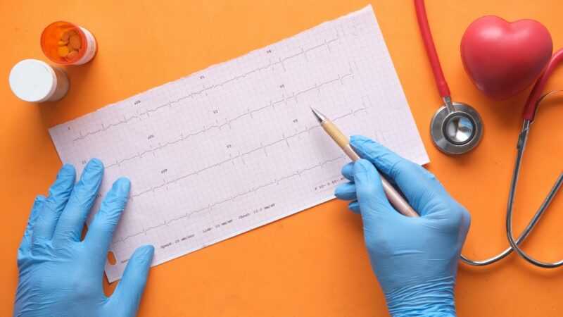 Control médico de salud cardiovascular, relacionado con la prevención del daño cardíaco por inflamación crónica